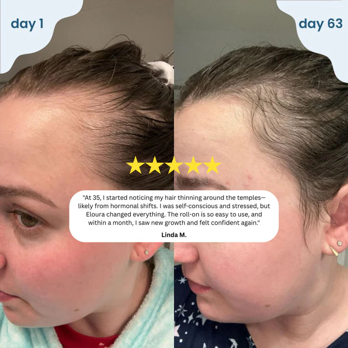 Rosavera™ Hair Revive Roll-On Serum