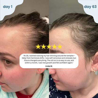 Rosavera™ Hair Revive Roll-On Serum